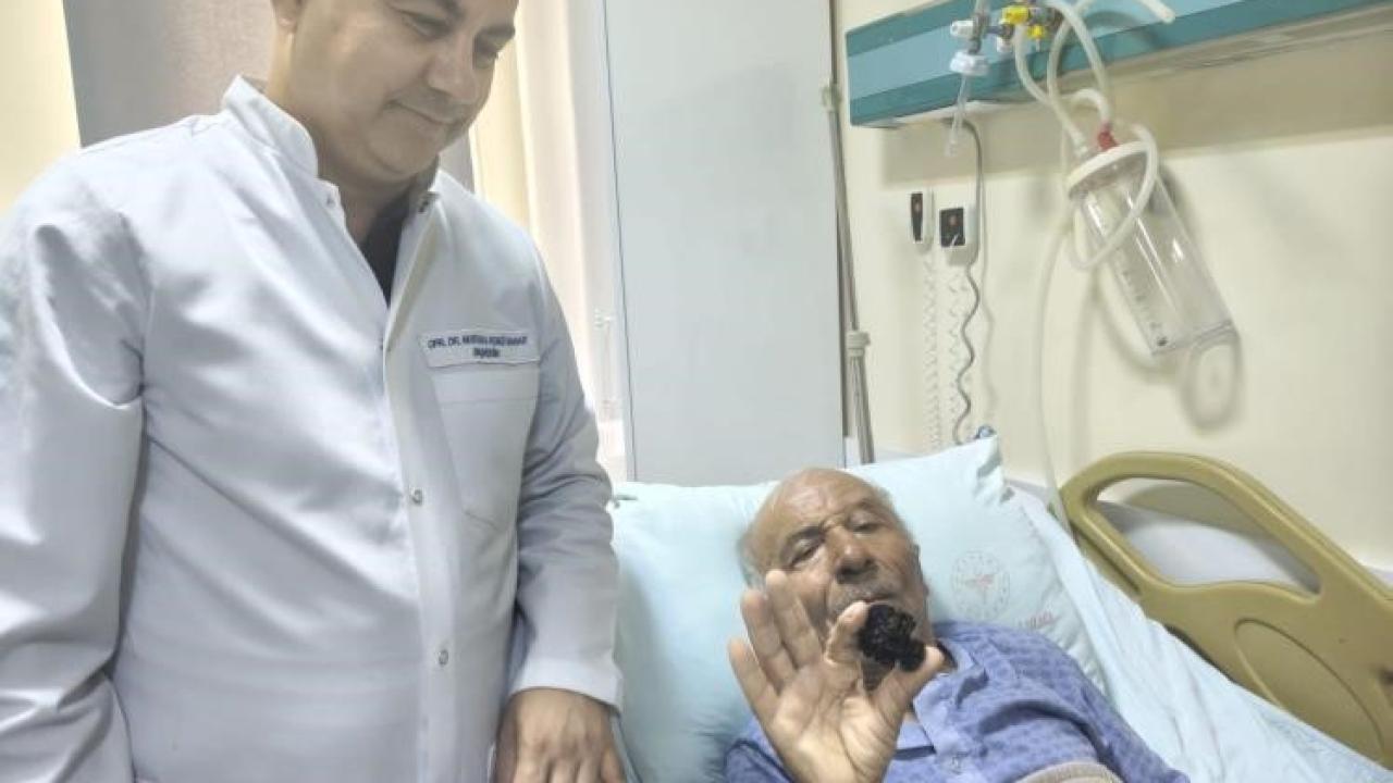 4 santimetrelik mesane taşı tek parça halinde çıkarıldı.