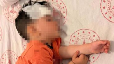 Sokak köpekleri 1 buçuk yaşındaki çocuğa saldırdı